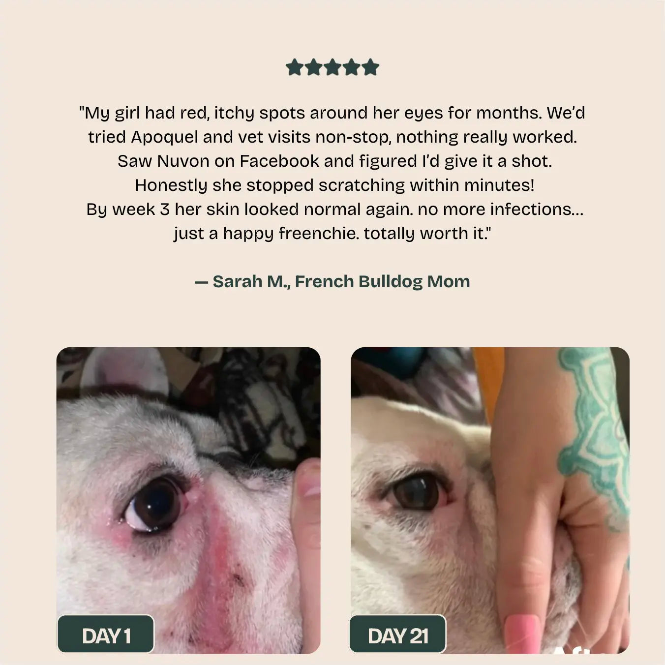 Nuvon Postbiotic Spray