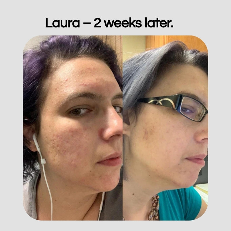 Bryft PureSkin Kit